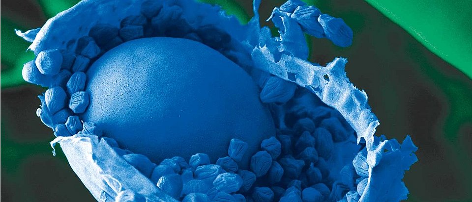 Der hier blau eingefärbte Rhizopus (japanischer Reispils) enthält die Rizoenzyme die für Nortase wichtig sind.