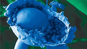 Der hier blau eingefärbte Rhizopus (japanischer Reispils) enthält die Rizoenzyme die für Nortase wichtig sind.